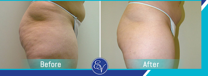 Before and After Photos of Patients of En Vogue Medi-Spa