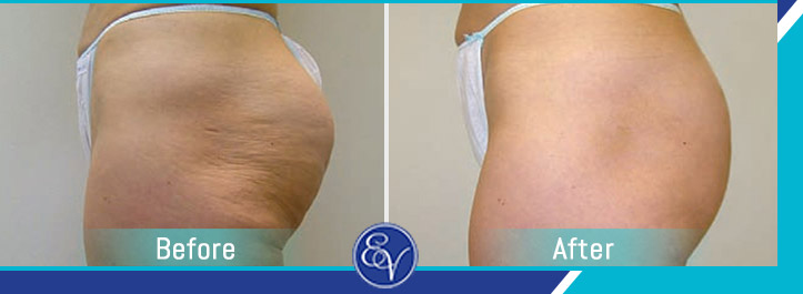 Before and After Photos of Patients of En Vogue Medi-Spa