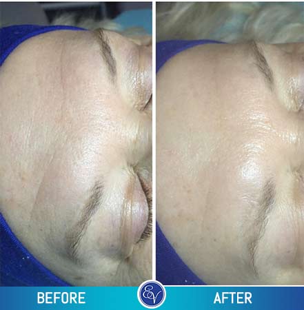 Before and After Photos Before and After Photos