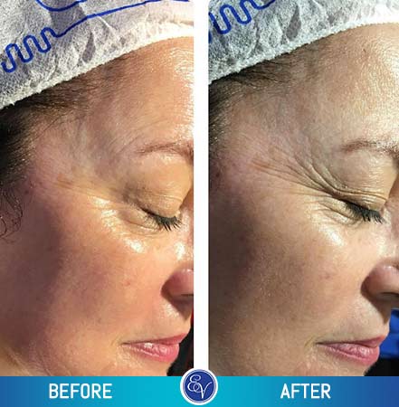 Before and After Photos Before and After Photos