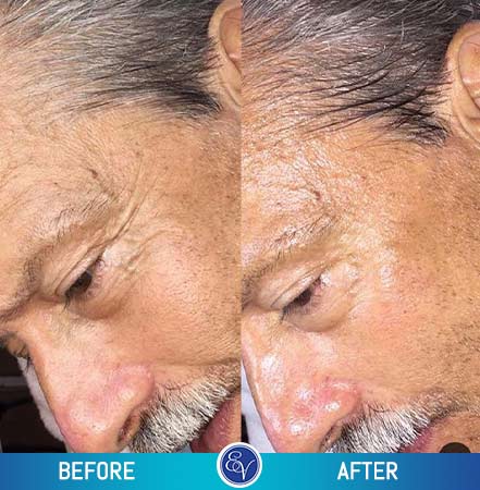 Before and After Photos Before and After Photos