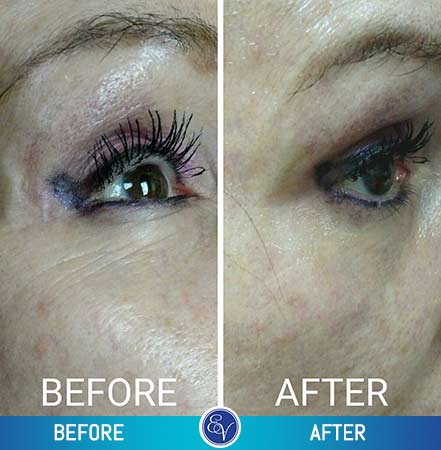 Before and After Photos Before and After Photos