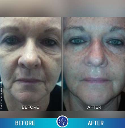 Before and After Photos Before and After Photos