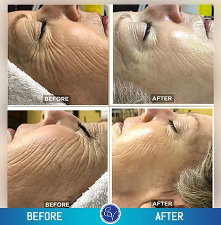 Before and After Photos Before and After Photos