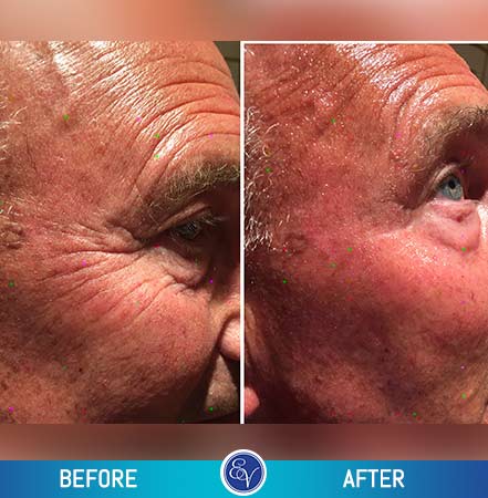Before and After Photos Before and After Photos