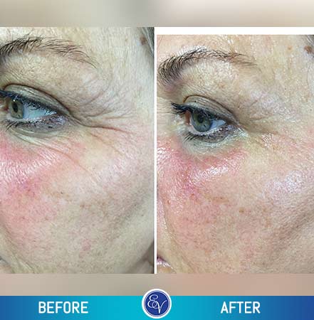 Before and After Photos Before and After Photos