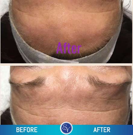 Before and After Photos Before and After Photos