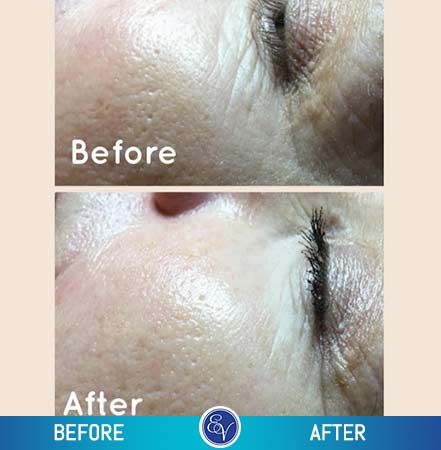 Before and After Photos Before and After Photos