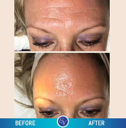 Before and After Photos Before and After Photos
