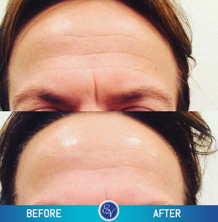 Before and After Photos Before and After Photos