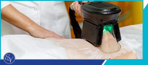 CoolSculpting Specialist Near Bucks County, PA CoolSculpting Specialist Near Bucks County, PA