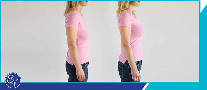 Breast Lift Surgery Specialist Near Me in Southampton, PA, and Langhorne, PA Breast Lift Surgery Specialist Near Me in Southampton, PA, and Langhorne, PA