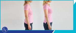 Breast Lift Surgery Specialist Near Me in Southampton, PA, and Langhorne, PA Breast Lift Surgery Specialist Near Me in Southampton, PA, and Langhorne, PA