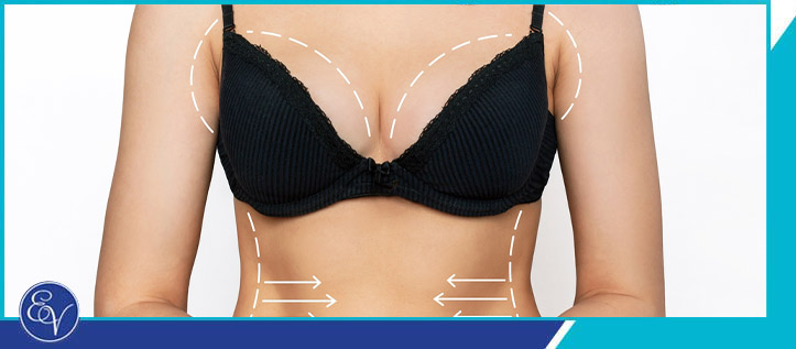 Breast Reduction Near Me in Southampton & Langhorne PA