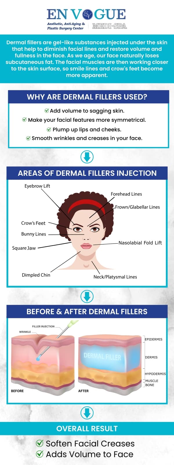 Dermal Filler Post Care at En Vogue Medi-Spa in Southampton, PA, and Langhorne, PA
