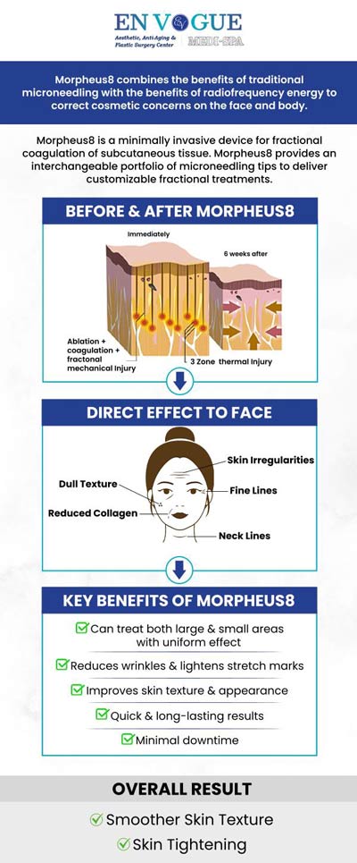 Morpheus8 helps with resorting to the aging face and body, for a more desired smooth and sleek appearance. Great with all skin types, Morpheus8 face treatments can reverse the signs of aging while treating several skin conditions in a non-invasive fashion. Morpheus8 face treatment is available at En Vogue Medi-Spa to meet your beauty needs. Our clinics are located in Southampton, PA and Langhorne, PA. For more information, contact our friendly staff to schedule a consultation. We are open 5 days a week and serve clients from Southampton PA, Langhorne PA, Newtown PA, Woodmont PA, Willow Grove PA, Horsham PA, Levittown PA, Parkland PA, and surrounding areas.