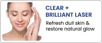 Clear + Brilliant Laser Treatment at En Vogue Medi-Spa in Southampton, PA and Langhorne, PA