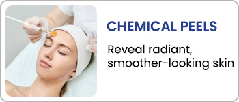 Chemical Peels at En Vogue Medi-Spa in Southampton, PA and Langhorne, PA