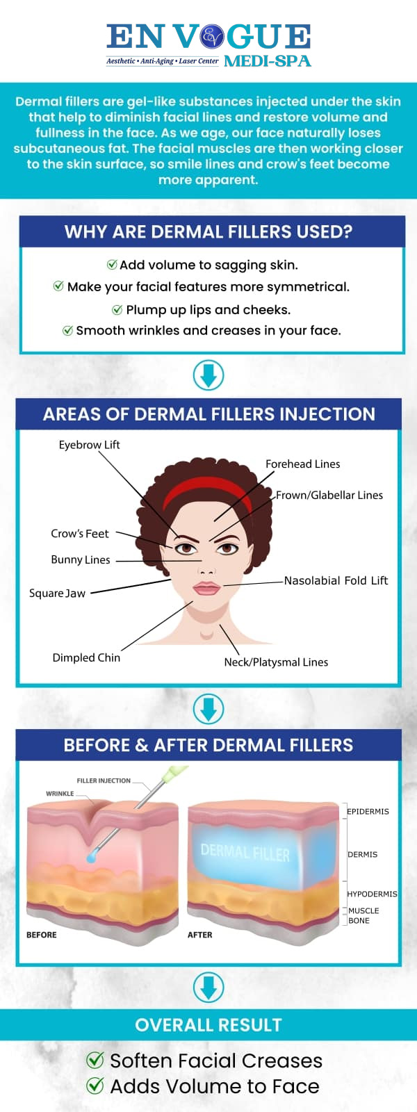 Common questions asked by clients: What are dermal fillers (Juvederm and Restylane)? What areas can be treated with dermal fillers? What are the potential side effects of dermal fillers? How long do the results of dermal fillers last? For more information, contact us or book an appointment online. Our clinic is located at 19 Summit Square Shopping Center, Langhorne, PA 19047. Common questions asked by clients: What are dermal fillers (Juvederm and Restylane)? What areas can be treated with dermal fillers? What are the potential side effects of dermal fillers? How long do the results of dermal fillers last? For more information, contact us or book an appointment online. Our clinic is located at 19 Summit Square Shopping Center, Langhorne, PA 19047.