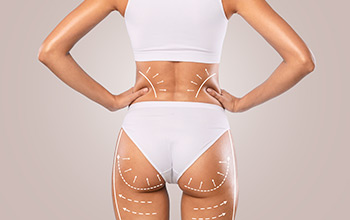 EMSCULPT Treatment Specialist at En Vogue Medi-Spa in Southampton, PA and Langhorne, PA