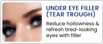 Under Eye Filler (Tear Trough) Treatment at En Vogue Medi-Spa in Southampton, PA and Langhorne, PA