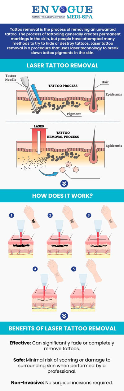 Safe and effective laser tattoo removal is available at En Vogue Medi-Spa. We will remove your unwanted tattoo. Please call us for more details or book an appointment online. We have convenient locations to serve you. Safe and effective laser tattoo removal is available at En Vogue Medi-Spa. We will remove your unwanted tattoo. Please call us for more details or book an appointment online. We have convenient locations to serve you.