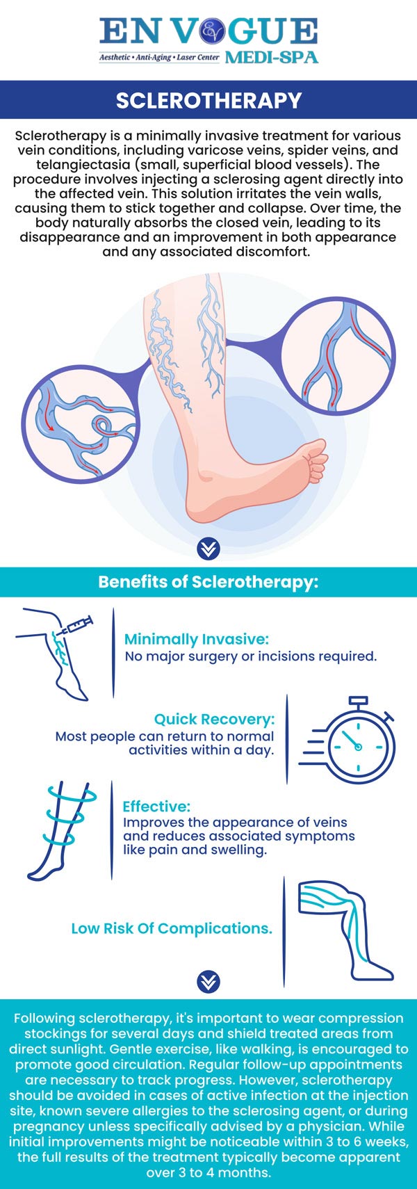 Sclerotherapy is a proven medical procedure to eliminate spider and varicose veins. It involves injecting a solution directly into the veins, causing them to collapse and fade over time. This treatment is highly effective, minimally invasive, and can significantly improve the appearance of the legs, providing relief from discomfort and swelling associated with problematic veins. For more information, contact us or book an appointment online. Our clinics are located in Southampton, PA and Langhorne, PA.