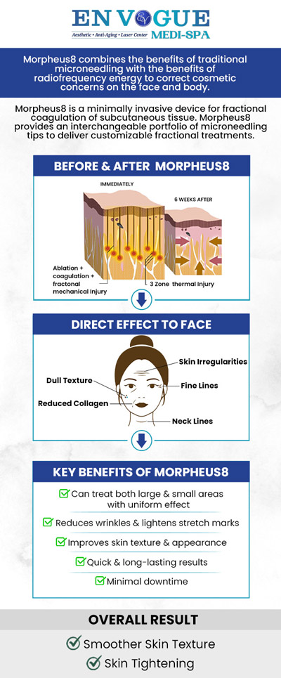 Morpheus8 is an advanced aesthetic treatment that combines microneedling and radiofrequency (RF) energy to target and improve the appearance of the skin. Morpheus8 body treatment specifically focuses on addressing skin laxity, stretch marks, cellulite, and other body concerns. Our clinics are located in Southampton, PA, and Langhorne, PA. For more information, contact our friendly staff to schedule a consultation. Morpheus8 is an advanced aesthetic treatment that combines microneedling and radiofrequency (RF) energy to target and improve the appearance of the skin. Morpheus8 body treatment specifically focuses on addressing skin laxity, stretch marks, cellulite, and other body concerns. Our clinics are located in Southampton, PA, and Langhorne, PA. For more information, contact our friendly staff to schedule a consultation.
