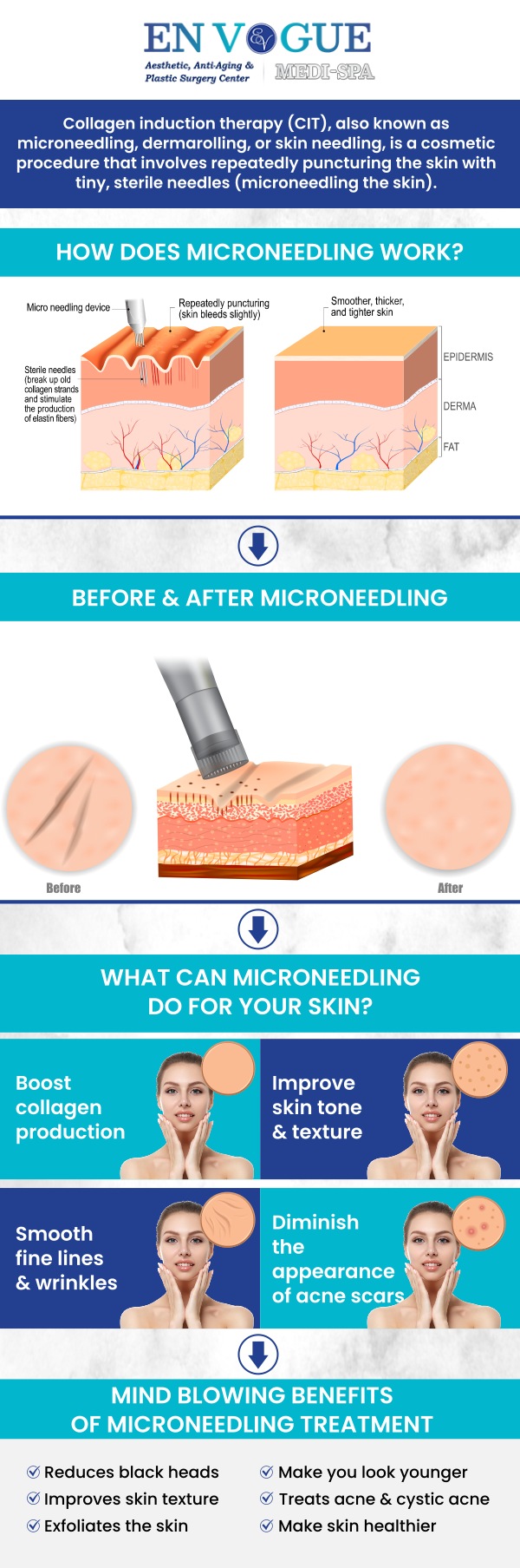 At En Vogue Medi Spa, our Microneedling treatments are designed to rejuvenate and enhance your skin's natural appearance. This non-invasive procedure uses tiny needles to stimulate collagen production, helping to reduce fine lines, wrinkles, and acne scars while improving skin texture and tone. Our experienced team will customize each session to meet your unique skin needs, leaving you with smoother, firmer, and more radiant skin. For more information, contact us or schedule an appointment online. We are conveniently located at 44 2nd St Pike, Southampton, PA 18966. At En Vogue Medi Spa, our Microneedling treatments are designed to rejuvenate and enhance your skin's natural appearance. This non-invasive procedure uses tiny needles to stimulate collagen production, helping to reduce fine lines, wrinkles, and acne scars while improving skin texture and tone. Our experienced team will customize each session to meet your unique skin needs, leaving you with smoother, firmer, and more radiant skin. For more information, contact us or schedule an appointment online. We are conveniently located at 44 2nd St Pike, Southampton, PA 18966.