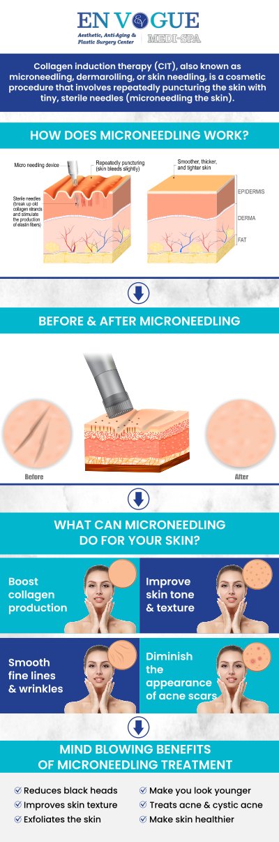 At En Vogue Medi Spa, our Microneedling treatments are designed to rejuvenate and enhance your skin's natural appearance. This non-invasive procedure uses tiny needles to stimulate collagen production, helping to reduce fine lines, wrinkles, and acne scars while improving skin texture and tone. Our experienced team will customize each session to meet your unique skin needs, leaving you with smoother, firmer, and more radiant skin. For more information, contact us or schedule an appointment online. We are conveniently located at 44 2nd St Pike, Southampton, PA 18966. At En Vogue Medi Spa, our Microneedling treatments are designed to rejuvenate and enhance your skin's natural appearance. This non-invasive procedure uses tiny needles to stimulate collagen production, helping to reduce fine lines, wrinkles, and acne scars while improving skin texture and tone. Our experienced team will customize each session to meet your unique skin needs, leaving you with smoother, firmer, and more radiant skin. For more information, contact us or schedule an appointment online. We are conveniently located at 44 2nd St Pike, Southampton, PA 18966.