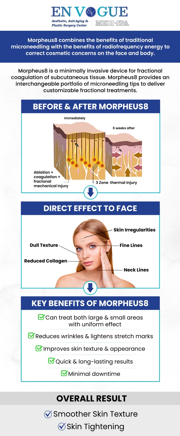 Common questions asked by clients: What is Morpheus8 RF Microneedling? What areas can be treated with Morpheus8? Are there any side effects of Morpheus8 RF microneedling? How many sessions of Morpheus8 are needed? For more information, contact us or book an appointment online. Our clinic is located at 19 Summit Square Shopping Center, Langhorne, PA 19047.